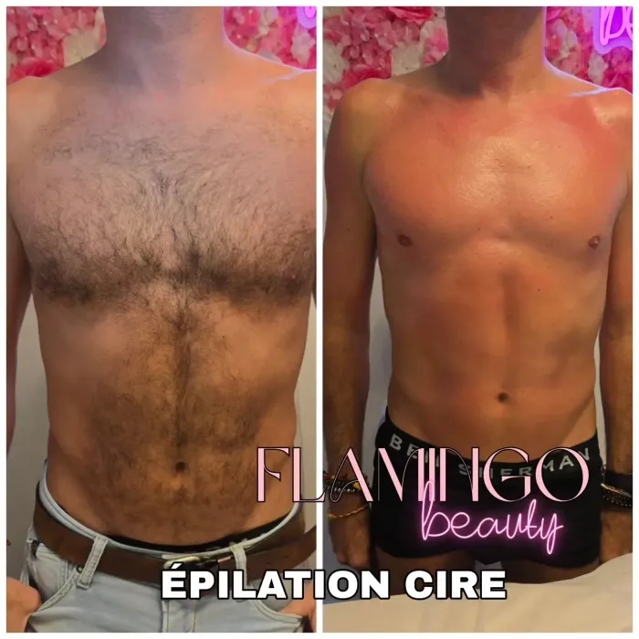 epilation pour homme nice